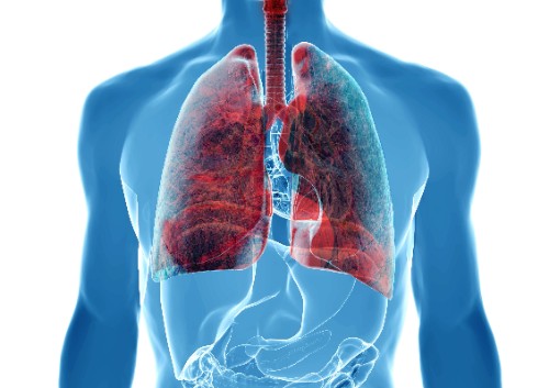 pki70233.jpg pki70233.jpg